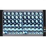 NEGATOSCOPIO LED DOBLE ULTRADELGADO 6500 LUX  XR-2