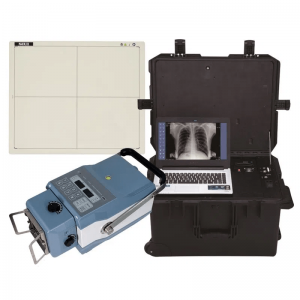 SISTEMA DE RADIOGRAFÍA PORTÁTIL XIGNAL. IMÁGENES EN HIGH DEFINITION.- DRX1